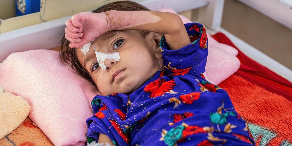 18-months old Amina is recovering from severe acute malnutrition with complications at  the UNICEF-supported Inpatient Therapeutic Feeding Centre in Herat Regional Hospital,

Her mother, 19-year-old Jahan Bibi, says she had to bring Amina to hospital because she could no longer nurse her baby anymore. 