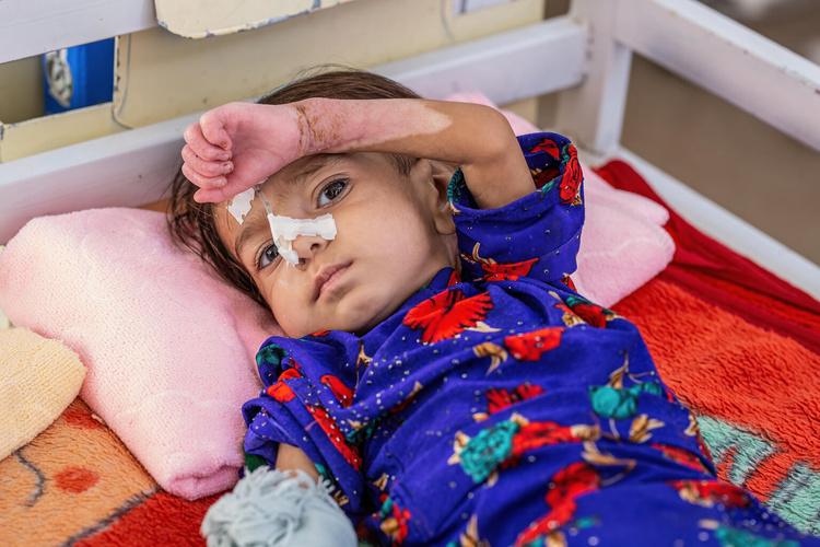 18-months old Amina is recovering from severe acute malnutrition with complications at  the UNICEF-supported Inpatient Therapeutic Feeding Centre in Herat Regional Hospital,

Her mother, 19-year-old Jahan Bibi, says she had to bring Amina to hospital because she could no longer nurse her baby anymore. 
